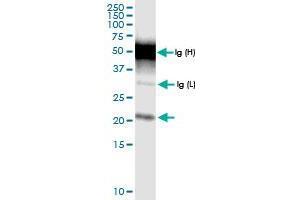 Immunoprecipitation of TMEM126B transfected lysate using rabbit polyclonal anti-TMEM126B and Protein A Magnetic Bead (TMEM126B (Human) IP-WB Antibody Pair)