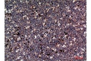 Immunohistochemical analysis of paraffin-embedded human-tonsils, antibody was diluted at 1:100.