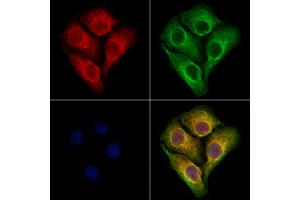 ABIN6264681 and ABIN6273070 staining Hela cells by IF/ICC. (RCN2 Antikörper  (C-Term))