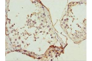 Immunohistochemistry of paraffin-embedded human testis tissue using ABIN7169215 at dilution of 1:100 (ULK4 Antikörper  (AA 1-290))