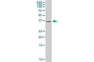 GYG1 monoclonal antibody (M08), clone 2C10. (Glycogenin 1 Antikörper  (AA 1-73))