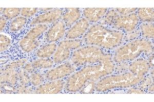 Detection of RIPK3 in Human Kidney Tissue using Polyclonal Antibody to Receptor Interacting Serine Threonine Kinase 3 (RIPK3) (RIPK3 Antikörper  (AA 1-217))