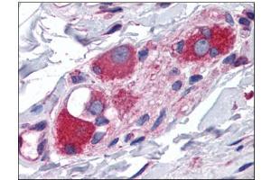 Human Small Intestine, Submucosal Plexus: Formalin-Fixed, Paraffin-Embedded (FFPE) (ARL6IP5 Antikörper  (C-Term))