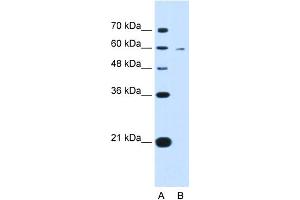 WB Suggested Anti-KYNU Antibody Titration:  0.