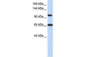 WB Suggested Anti-THRAP3 Antibody Titration:  0.
