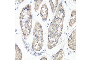Immunohistochemistry (Paraffin-embedded Sections) (IHC (p)) image for anti-PTK2 Protein tyrosine Kinase 2 (PTK2) (AA 700-800) antibody (ABIN6146423)