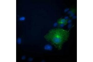 Anti-PRKAR1B mouse monoclonal antibody (ABIN2454494) immunofluorescent staining of COS7 cells transiently transfected by pCMV6-ENTRY PRKAR1B (RC207809). (PRKAR1B Antikörper)