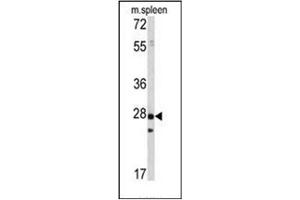 Image no. 1 for anti-Protein Tyrosine Phosphatase Type IVA, Member 1 (PTP4A1) antibody (ABIN360770)