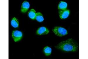 IF analysis of FXR1 using anti-FXR1 antibody (ABIN7600093).