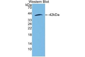 Western blot analysis of the recombinant protein. (MGP Antikörper  (AA 23-103))