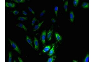 Immunofluorescent analysis of Hela cells using ABIN7169869 at dilution of 1:100 and Alexa Fluor 488-congugated AffiniPure Goat Anti-Rabbit IgG(H+L) (SNRPG Antikörper  (AA 1-76))