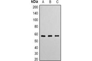 Western blot analysis of Angiopoietin-1 expression in K562 (A), Hela (B), Jurkat (C) whole cell lysates. (Angiopoietin 1 Antikörper  (N-Term))