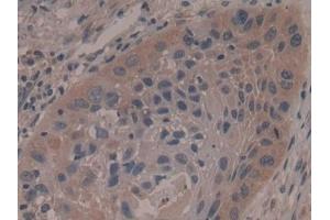 Immunohistochemistry (IHC) image for anti-Ribosomal Protein S6 Kinase, 90kDa, Polypeptide 1 (RPS6KA1) (AA 62-321) antibody (ABIN7441682)