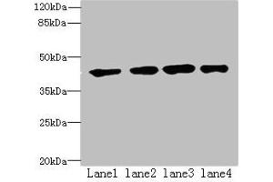 Western blot All lanes: QTRT1 antibody at 6 μg/mL Lane 1: MCF-7 whole cell lysate Lane 2: PC-3 whole cell lysate Lane 3: Jurkat whole cell lysate Lane 4: A431 whole cell lysate Secondary Goat polyclonal to rabbit IgG at 1/10000 dilution Predicted band size: 45, 25 kDa Observed band size: 45 kDa (QTRT1 Antikörper  (Catalytic Subunit 1))