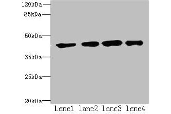 QTRT1 antibody  (Catalytic Subunit 1)