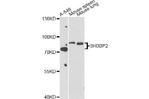 Western blot analysis of extracts of various cell lines, using SH3BP2 antibody (ABIN5998800) at 1/1000 dilution. (SH3BP2 Antikörper)