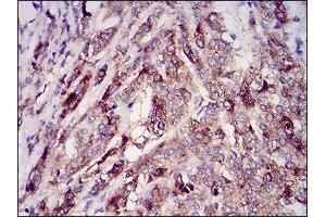 Immunohistochemistry (IHC) image for anti-RAB27A, Member RAS Oncogene Family (RAB27A) (AA 1-221) antibody (ABIN2683011)