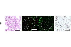 Immunofluorescence (Paraffin-embedded Sections) (IF (p)) image for anti-Ataxia Telangiectasia Mutated (ATM) (AA 1974-1988), (pSer1981) antibody (ABIN6656104)