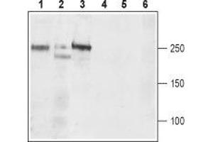 Western blot analysis of rat brain (lanes 1 and 4), mouse brain (lanes 2 and 5), and rat C6  brain Glioma (lanes 3 and 6) lysates: - 1-3. (CACNA1D Antikörper  (2nd Extracellular Loop, Repeat region))