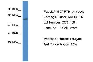 Western Blotting (WB) image for anti-Cytochrome P450, Family 7, Subfamily B, Polypeptide 1 (CYP7B1) (C-Term) antibody (ABIN2788601) (CYP7B1 Antikörper  (C-Term))
