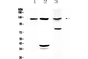 Western blot analysis of MUC1 using anti-MUC1 antibody .