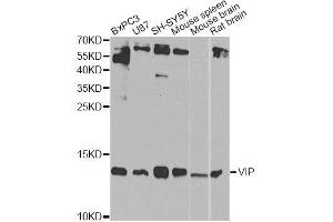 Western blot analysis of extracts of various cell lines, using VIP Antibody.