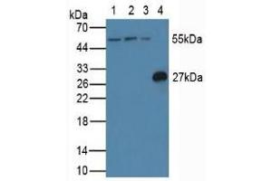 Western blot analysis of (1) Human Jurkat Cells, (2) Human HeLa cells, (3) Human K562 Cells and (4) Rat Spleen Tissue. (FLIP Antikörper  (AA 43-281))