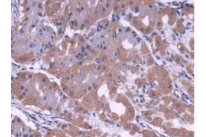 Detection of COVA1 in Human Stomach Tissue using Polyclonal Antibody to Cytosolic Ovarian Carcinoma Antigen 1 (COVA1) (ENOX2 Antikörper  (AA 1-207))