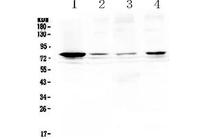 Western blot analysis of RANK using anti-RANK antibody . (TNFRSF11A Antikörper  (AA 34-211))