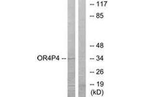 Western blot analysis of extracts from HeLa cells, using OR4P4 Antibody. (OR4P4 Antikörper  (AA 260-309))