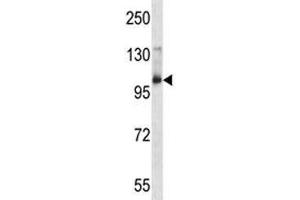 Aak1 antibody western blot analysis in mouse bladder tissue lysate. (AAK1 Antikörper  (AA 279-306))