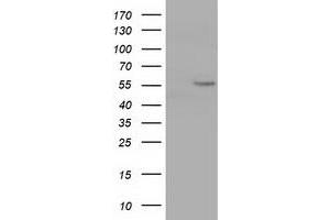 Western Blotting (WB) image for anti-Cytochrome P450, Family 1, Subfamily A, Polypeptide 2 (CYP1A2) antibody (ABIN1497715) (CYP1A2 Antikörper)