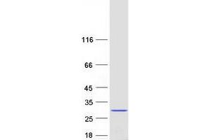 Validation with Western Blot (C5orf24 Protein (Transcript Variant 2) (Myc-DYKDDDDK Tag))