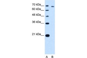 Western Blotting (WB) image for anti-threonyl-tRNA Synthetase (TARS) antibody (ABIN2462975) (TARS Antikörper)