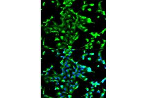 Immunofluorescence analysis of A549 cell using ANXA2 antibody. (Annexin A2 Antikörper)