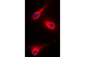 Immunofluorescent analysis of PLC gamma 1 (pY1253) staining in A431 cells. (Phospholipase C gamma 1 Antikörper  (C-Term, pTyr1253))