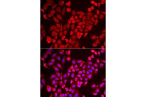 Immunofluorescence analysis of U2OS cells using TNP2 antibody (ABIN5974101). (TNP2 Antikörper)