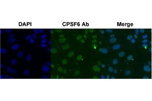 Immunofluorescent staining of SK-OV-3 cell with CPSF6 polyclonal antibody  under 4 ug/mL working concentration. (CPSF6 Antikörper  (AA 261-310))