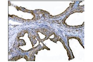 IHC analysis of DLGAP1 using anti-DLGAP1 antibody (ABIN7600257).