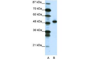 WB Suggested Anti-MEOX2 Antibody Titration:  1. (MEOX2 Antikörper  (C-Term))