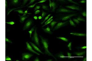 Immunofluorescence of monoclonal antibody to HGD on HeLa cell. (HGD Antikörper  (AA 377-445))