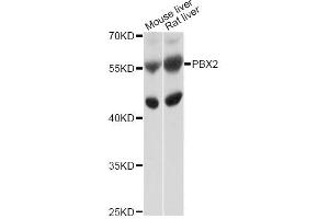 Western blot analysis of extracts of various cell lines, using PBX2 antibody (ABIN4904689) at 1:1000 dilution.
