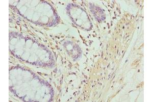Immunohistochemistry of paraffin-embedded human colon tissue using ABIN7143144 at dilution of 1:100