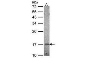 Image no. 2 for anti-Ubiquitin-Conjugating Enzyme E2B (UBE2B) (AA 7-152) antibody (ABIN467405) (UBE2B Antikörper  (AA 7-152))