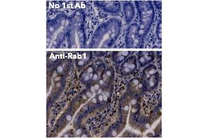 Immunohistochemistry (IHC) image for anti-RAB1A, Member RAS Oncogene Family (RAB1A) (C-Term) antibody (ABIN1440053)
