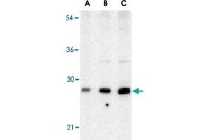Western blot analysis of BCAP29 in human heart tissue lysate with BCAP29 polyclonal antibody  at (A) 0.