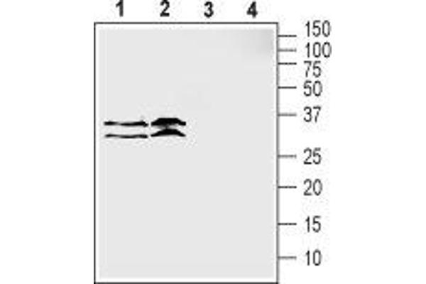 SLC39A3 Antikörper  (1st Extracellular Loop)