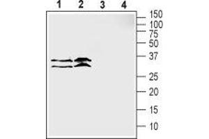 Western blot analysis of human MCF-7 breast adenocarcinoma cell lysate (lanes 1 and 3) and human LNCaP prostate adenocarcinoma cell lysate (lanes 2 and 4): - 1,2. (SLC39A3 Antikörper  (1st Extracellular Loop))