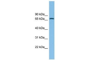 GLUD2 antibody used at 1 ug/ml to detect target protein. (GLUD2 Antikörper  (N-Term))
