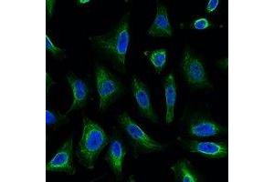 Immunofluorescent analysis of Aquaporin 4 staining in Hela cells. (Aquaporin 4 Antikörper)
